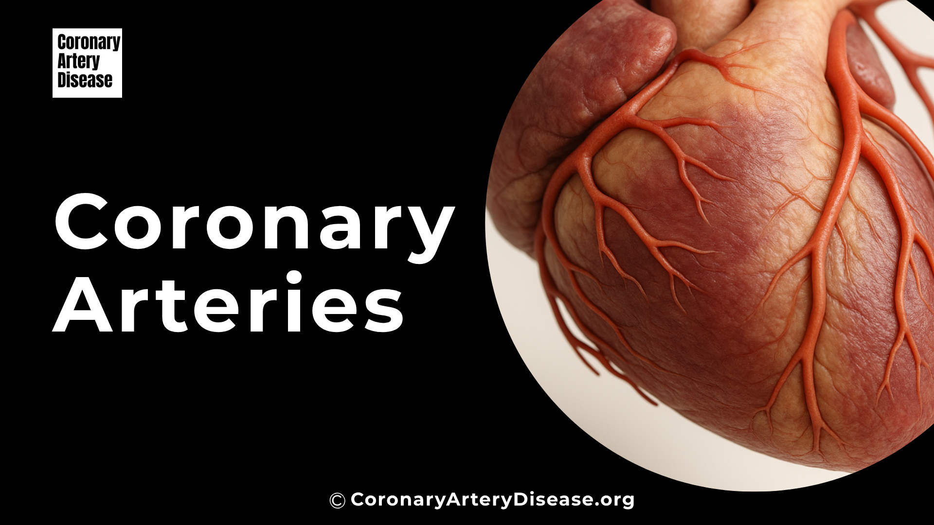 Coronary Arteries