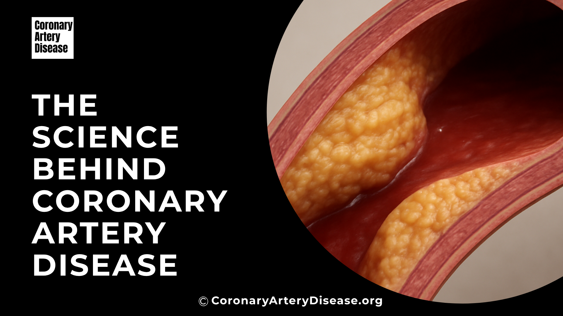 The Science behind coronary artery disease