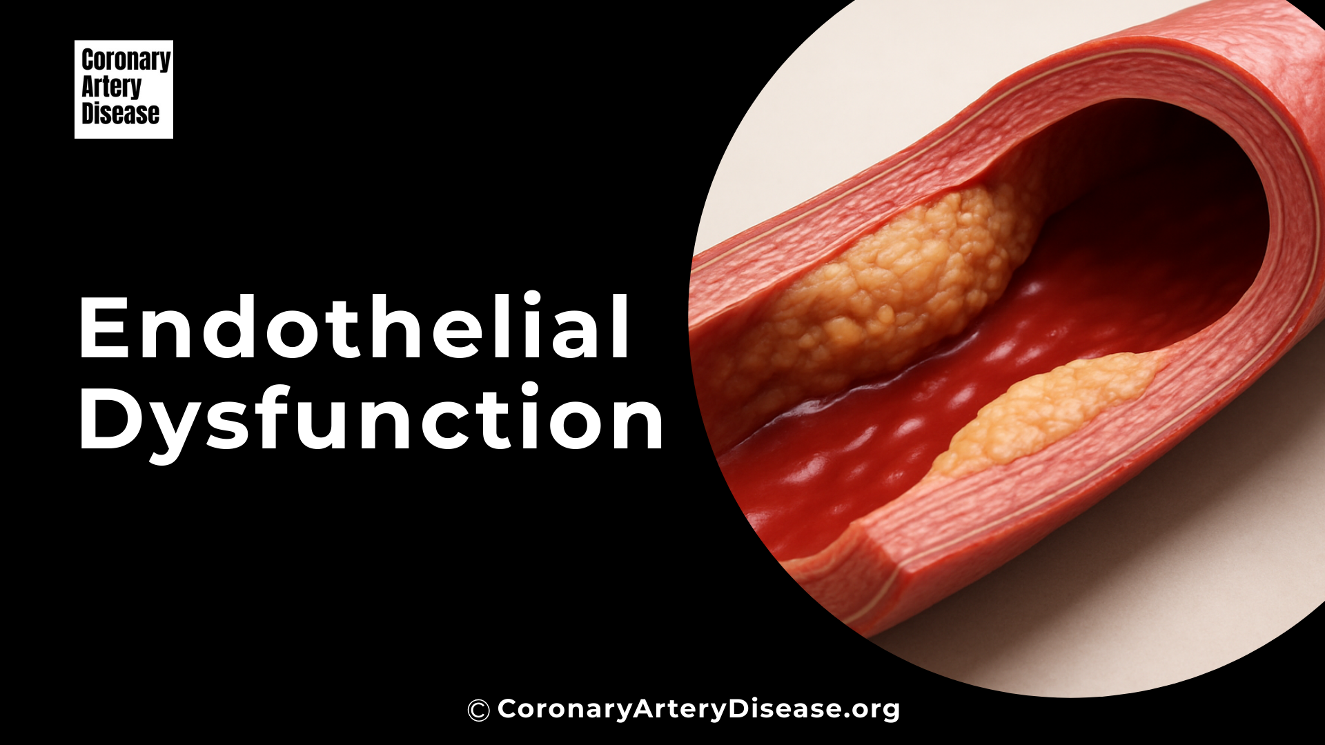Endothelial Dysfunction image